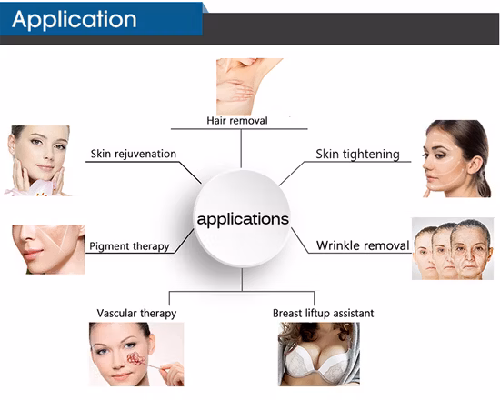 Hot Sale Nouvel An Promotion Photon Rajeunissement de la peau Épilation rapide IPL
