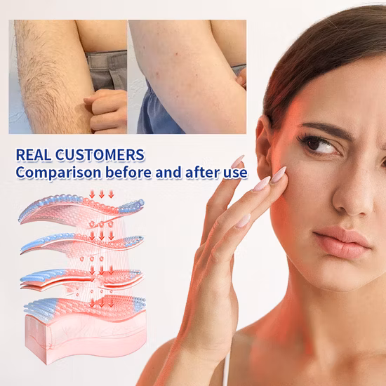 Ice Cool équipement de beauté de haute qualité épilation indolore laser IPL