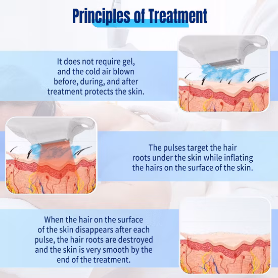 2022 Hot Sale Professional Photon Rajeunissement IPL Hair Removal Beauty Equipment